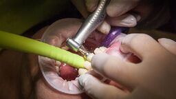 zdjęcie ilustracyjne