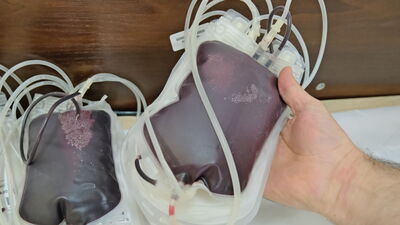 Pilnie potrzebna krew. Zwłaszcza ta jedna, najcenniejsza grupa