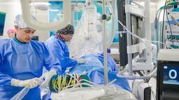 Zabiegi ablacji z użyciem nowej techniki 