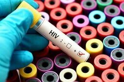 "Tramwaj zwany Pożądaniem" znów w Lublinie. Studenci dla profilaktyki HIV