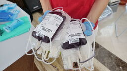 Ratuje życie. Sprawdź, gdzie oddać krew w Lubelskiem