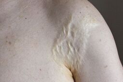 Ogień w roli głównej. Zaproszenie na wernisaż w Ratuszu