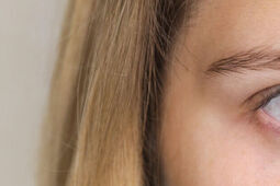 Astygmatyzm a stożek rogówki – czym się różnią i co je łączy?