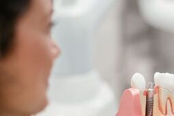 Implanty zębów. Czemu nie warto ryzykować z przypadkowymi gabinetami?