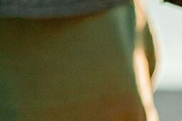 Uwiązany pies pogryzł biegaczkę, a właścicielka była po alkoholu