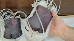 Lekarze biją na alarm. Tych dwóch grup krwi już nie ma w magazynach