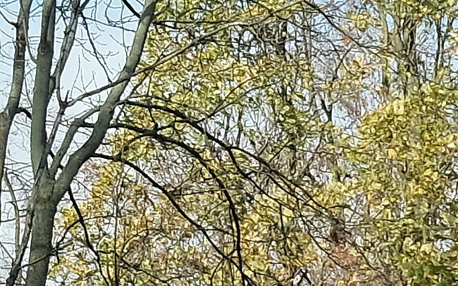 Bezpłatne badania piersi w mammobusie. Sprawdź, kiedy przyjedzie do Twojej miejscowości