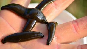 Makabryczna śmierć. Pijawki wyssały z mężczyzny krew