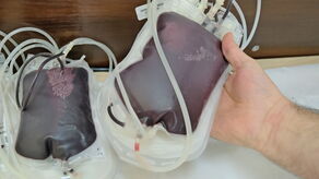 Dwóch grup krwi praktycznie nie ma. RCKiK zaprasza na akcje oddawania krwi